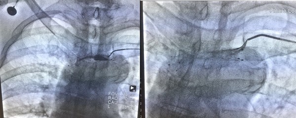 QQ截图20180903174135.png